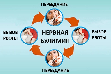 Лечение булимии в Учкекене